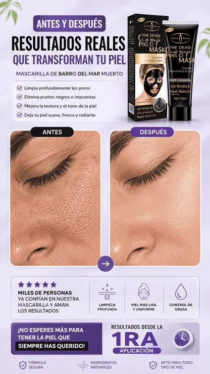 Mascarilla Gold Black Puntos Negros - ULTIMAS 7 UNIDADES