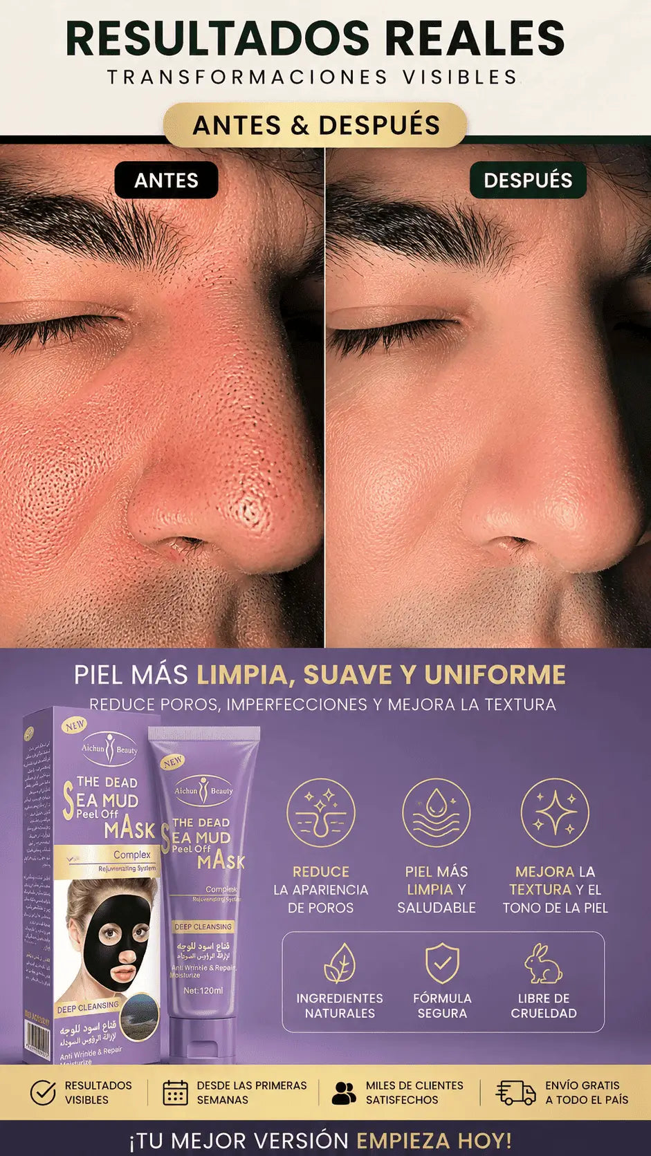 Mascarilla Gold Black Puntos Negros - ULTIMAS 7 UNIDADES